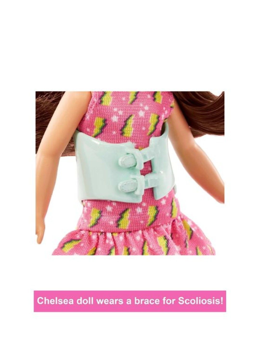 Barbie Chelsea Doll with Brace for Scoliosis (No Color- Image 2)
