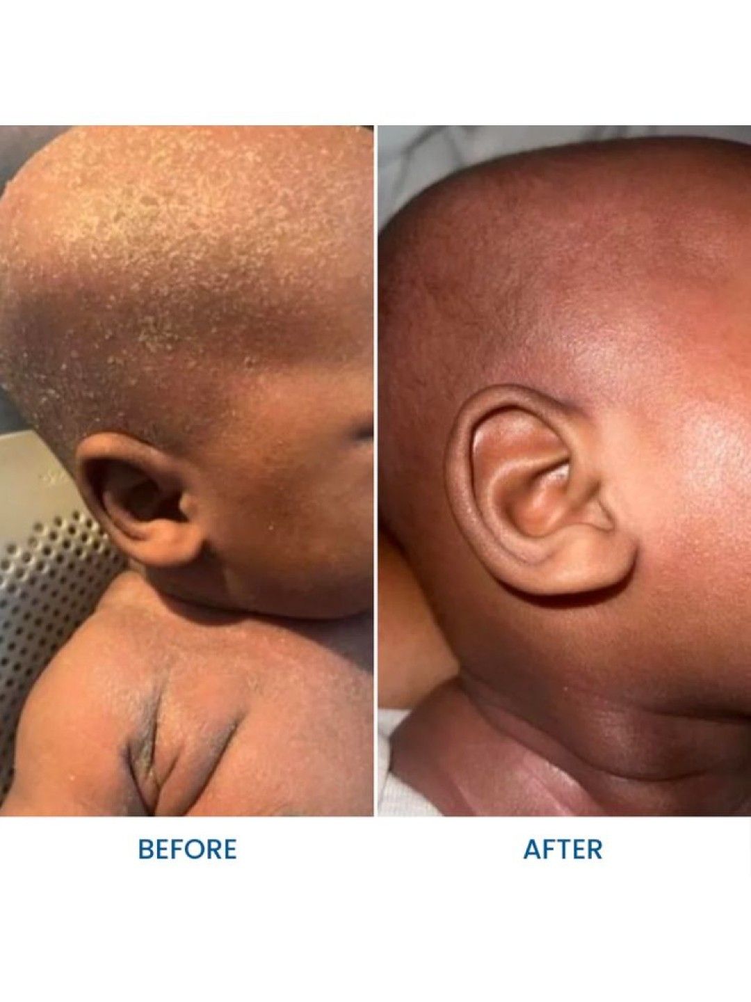 Grahams Natural Baby Eczema Body and Bath Oil (100ml) (No Color- Image 3)