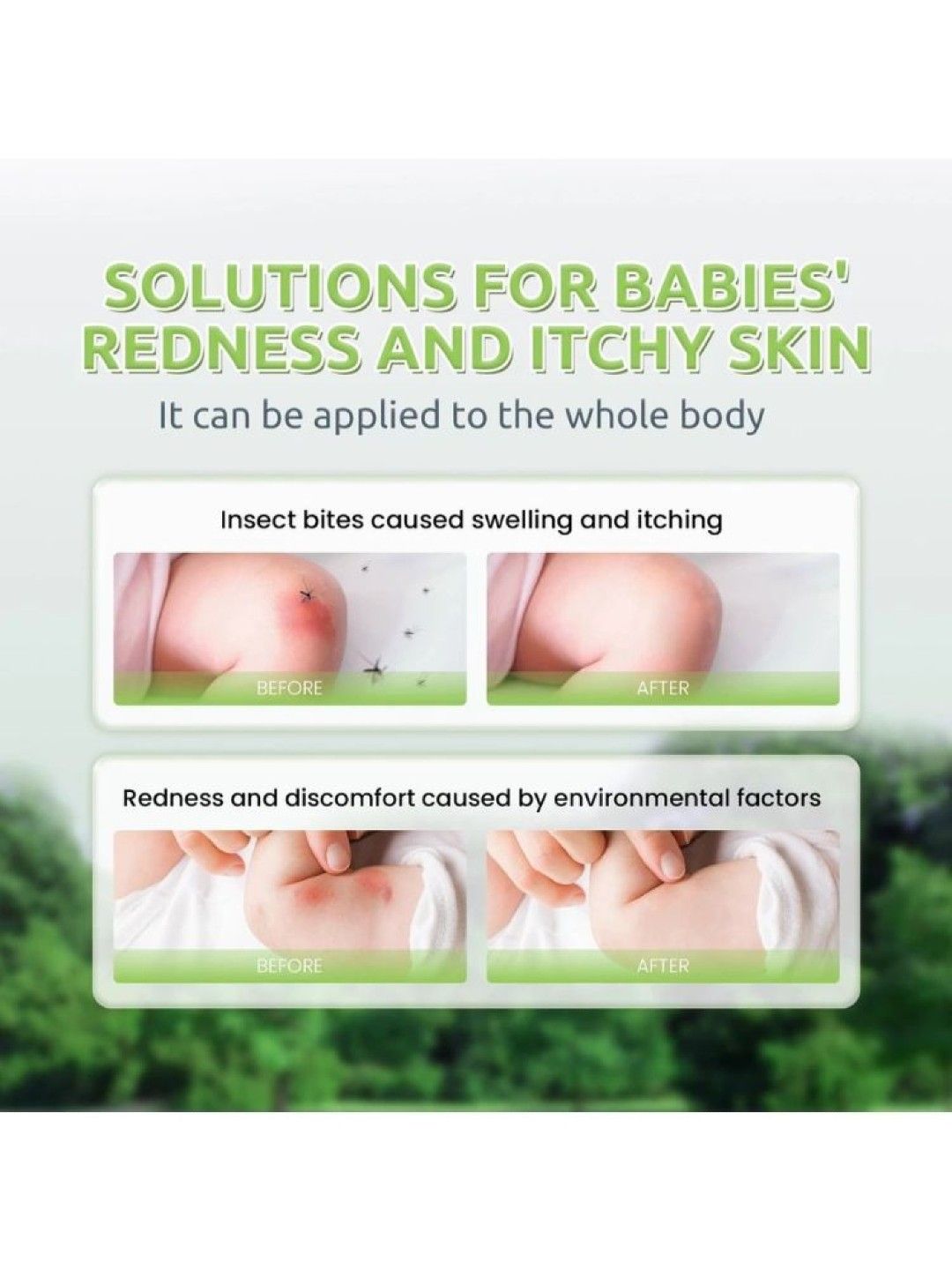 Tenderoo Natural Soothing Roll-On 18ml (No Color- Image 2)