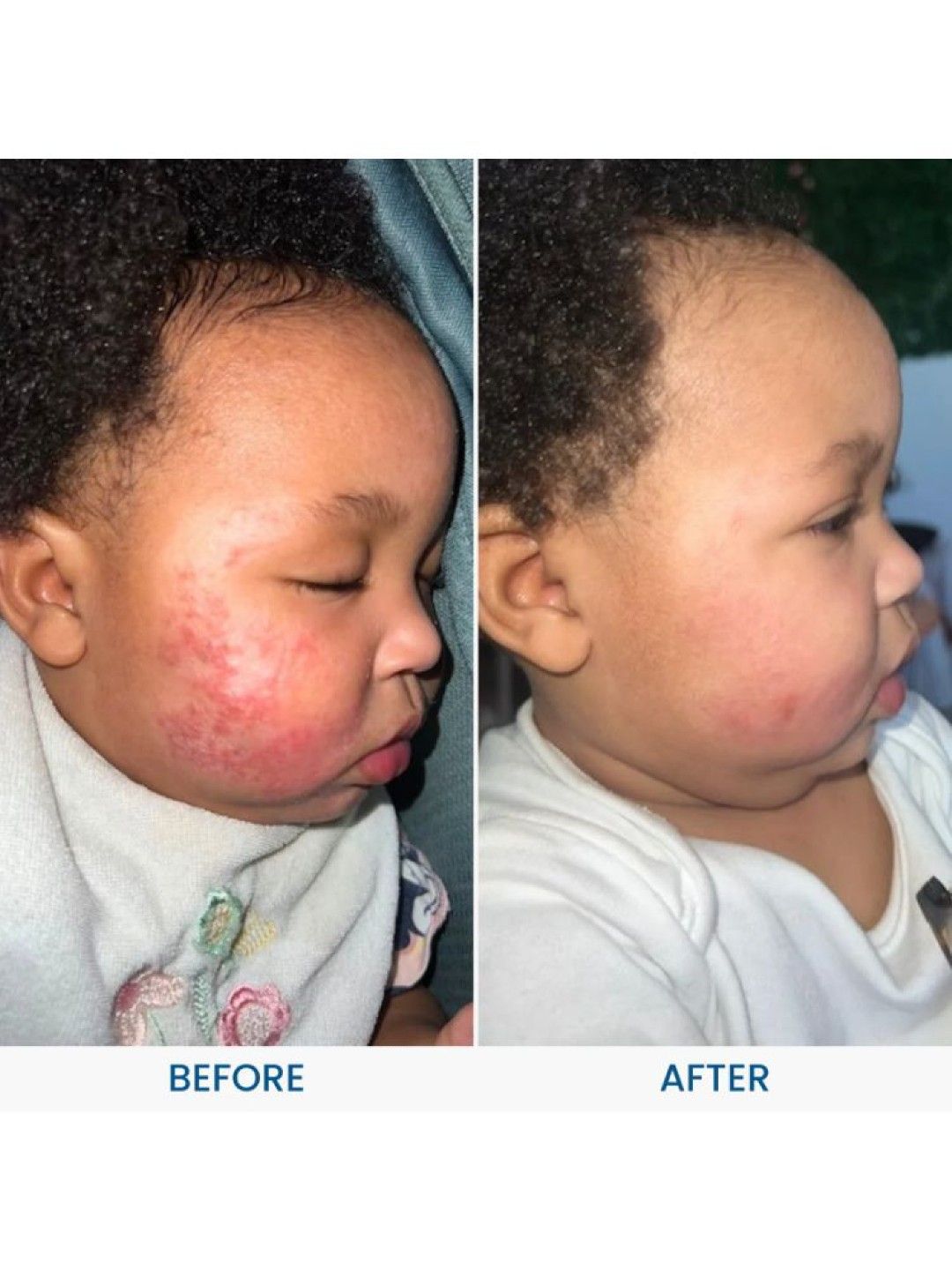 Grahams Natural Baby Eczema Cream (150g) (No Color- Image 4)