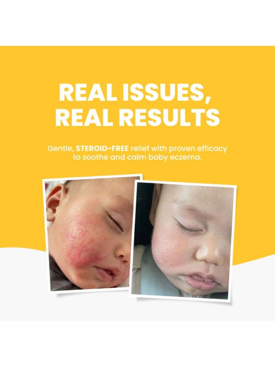 Grahams Natural Baby Eczema Cream (75g) (No Color- Image 3)
